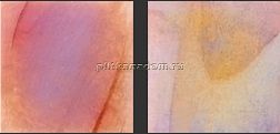 Rose Mosaic Rainbow WВ87 (формат 1х1) Мозаика 31,8х31,8 см